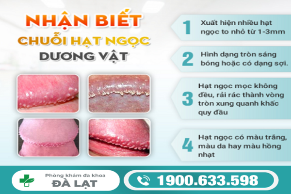 Hình ảnh minh họa